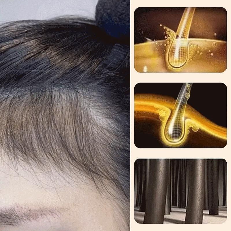 Polygonum Hair Cleansing Soap (pack of 2 )